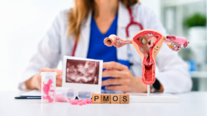 σύνδρομο πολυκυστικών ωοθηκών pmos, pcos